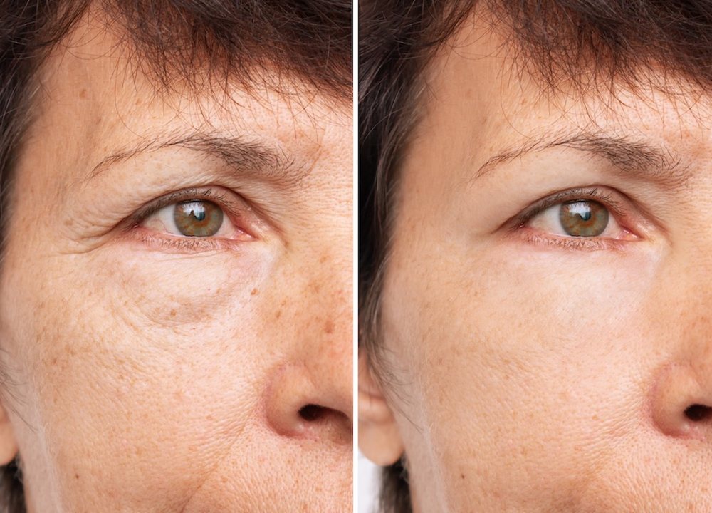 Chirurgie esthétique